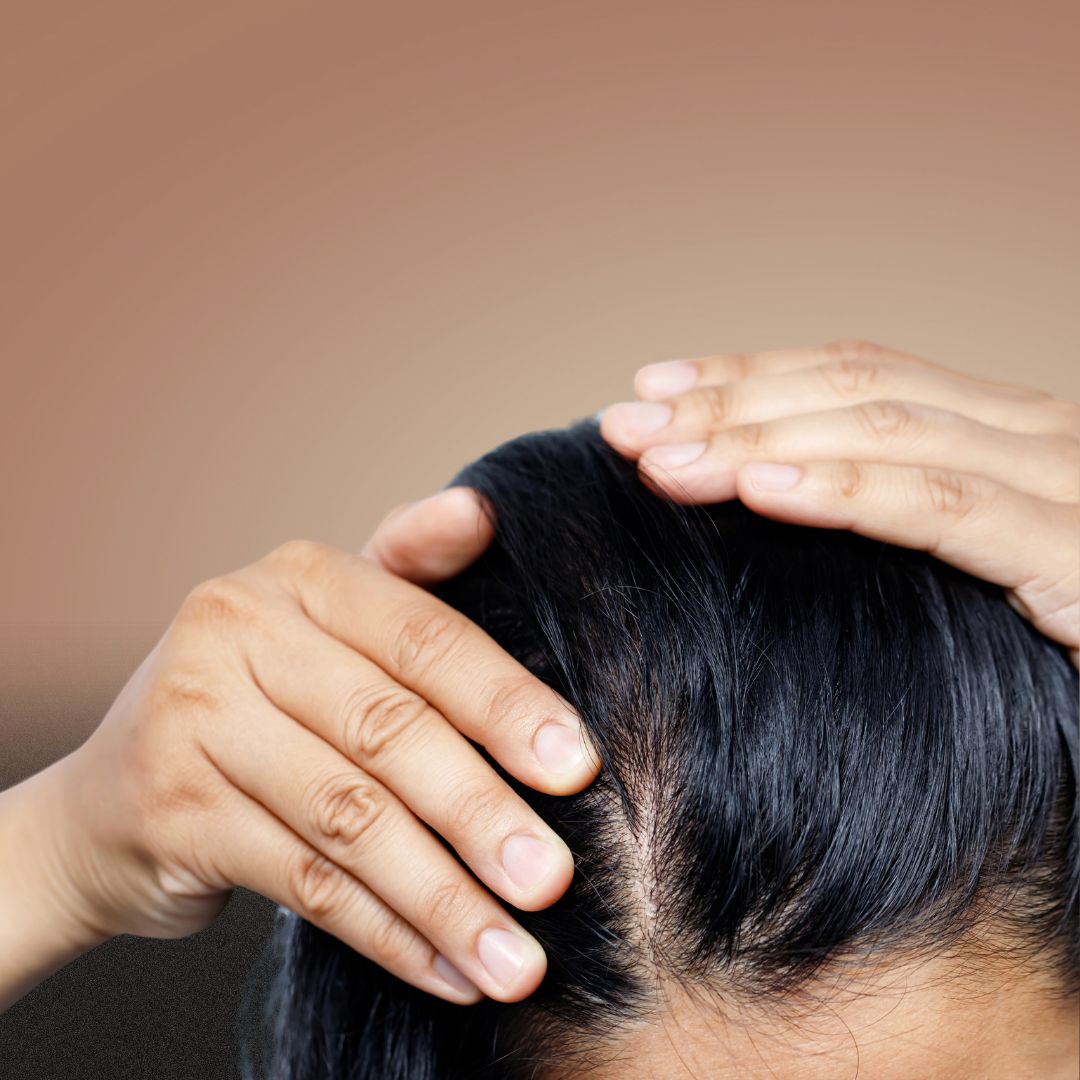 Sunshine Deficiency: Unveiling the Link Between Vitamin D and Hair Loss